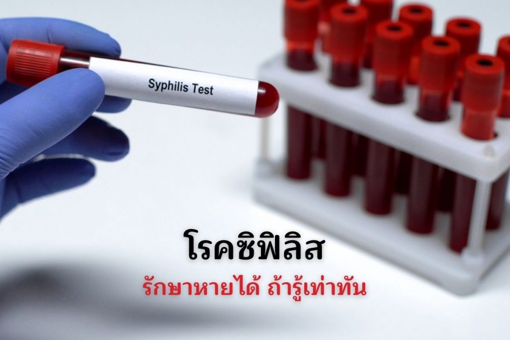 โรคซิฟิลิส รักษาหายได้ ถ้ารู้เท่าทัน