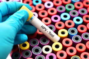 HPV เอชพีวี หูดหงอนไก่ ตรวจคัดกรองมะเร็งปากมดลูก มะเร็งอัณฑะ โรคติดต่อทางเพศสัมพันธ์ วัคซีนเอชพีวี เอดส์ เอชไอวี ตรวจเลือด กามโรค