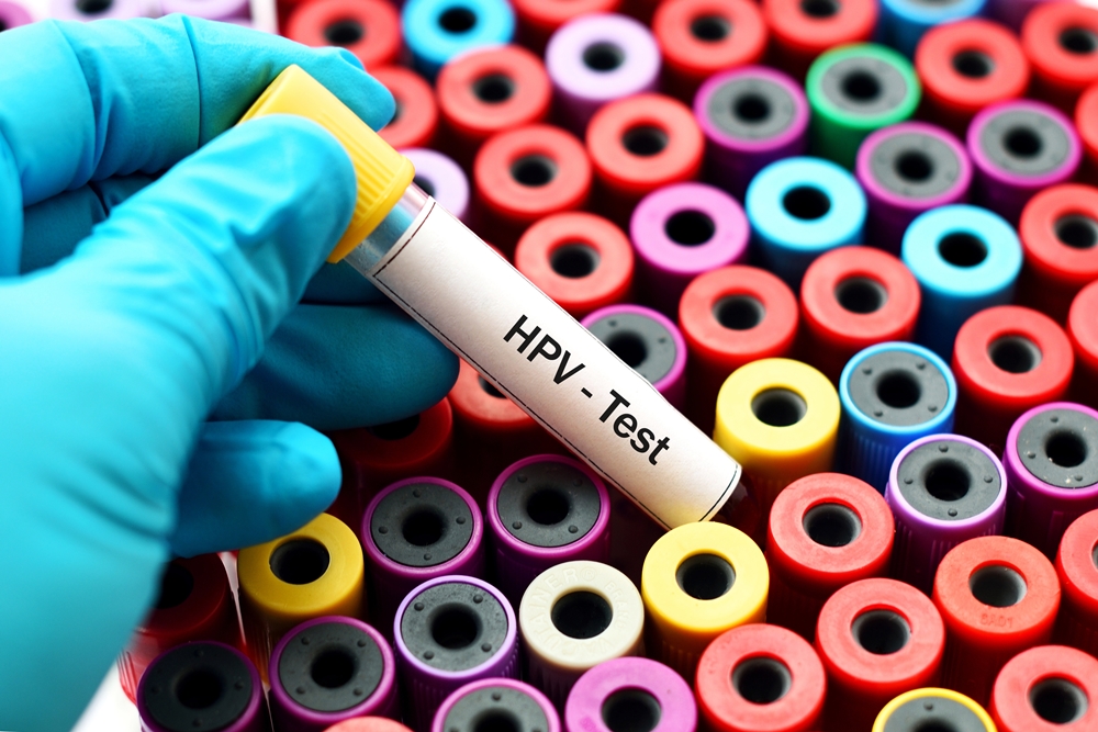 HPV เอชพีวี หูดหงอนไก่ ตรวจคัดกรองมะเร็งปากมดลูก มะเร็งอัณฑะ โรคติดต่อทางเพศสัมพันธ์ วัคซีนเอชพีวี เอดส์ เอชไอวี ตรวจเลือด กามโรค