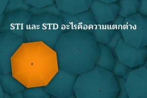 STI_STDความแตกต่าง