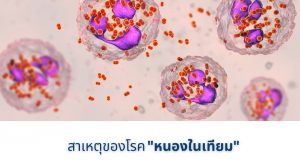 สาเหตุของโรคหนองในเทียม